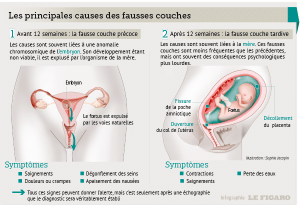 les étapes de la fausse couche