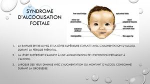 les effets de l'alcoolisation foetale